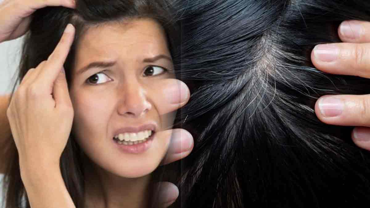 cheveux blancs